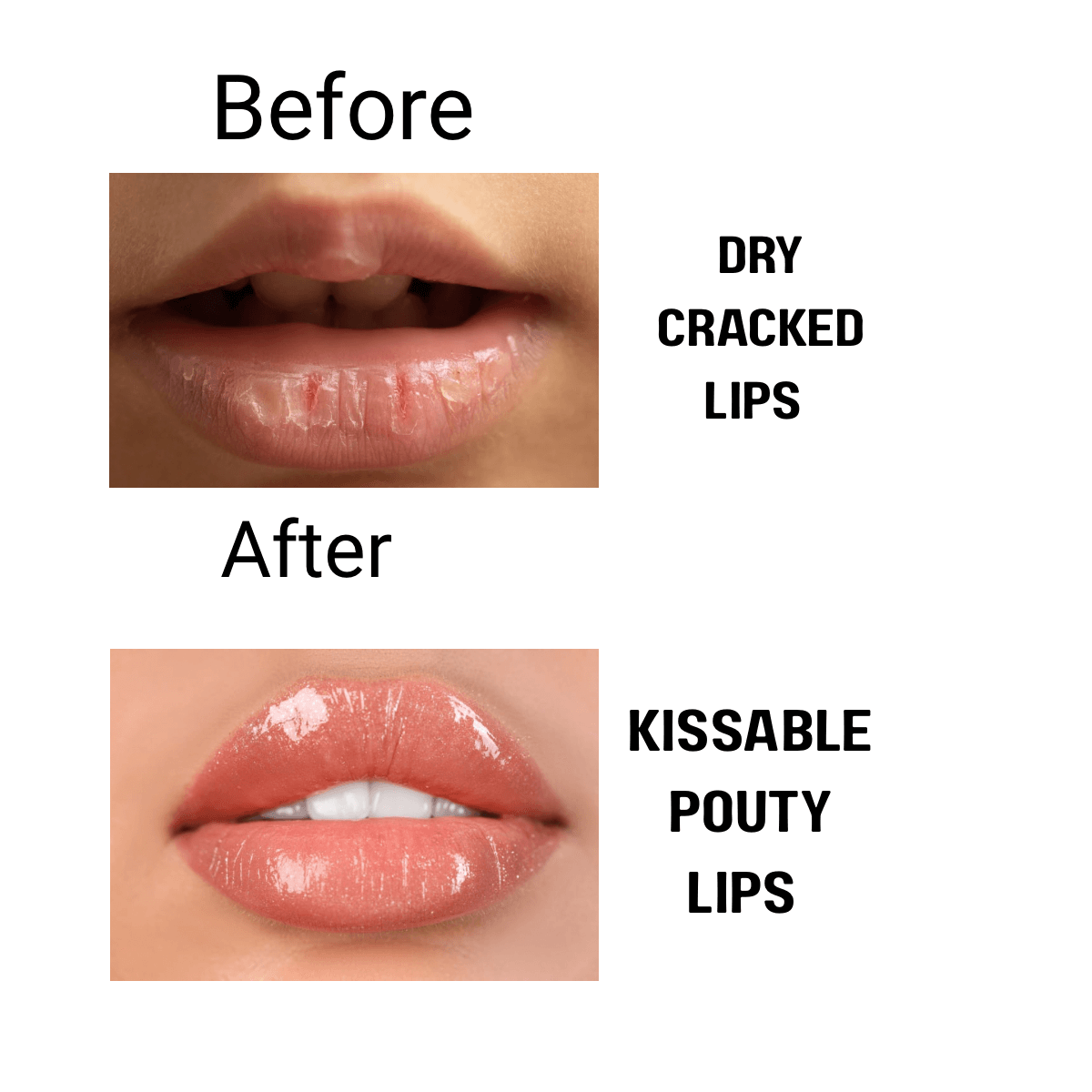 Glowbloomworld Lip Revitalizer Microneedle Set